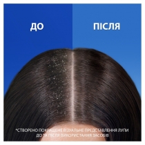 Шампунь проти лупи Head & Shoulders Заспокійливий догляд, 400 мл