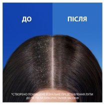 Шампунь проти лупи Head & Shoulders Проти випадіння волосся для жінок 400 мл