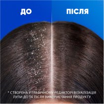 Шампунь против перхоти Head & Shoulders Гладкое и шелковистое 250мл