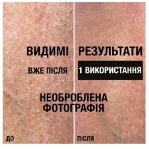 Лосьйон для тіла Neutrogena® Інтенсивне  відновлення 250 мл